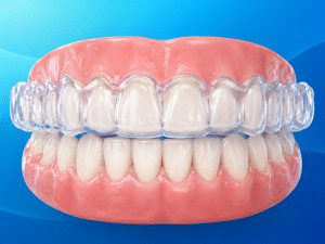 Mouth Guard